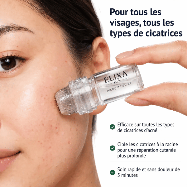 Kit Microneedling anti-acné